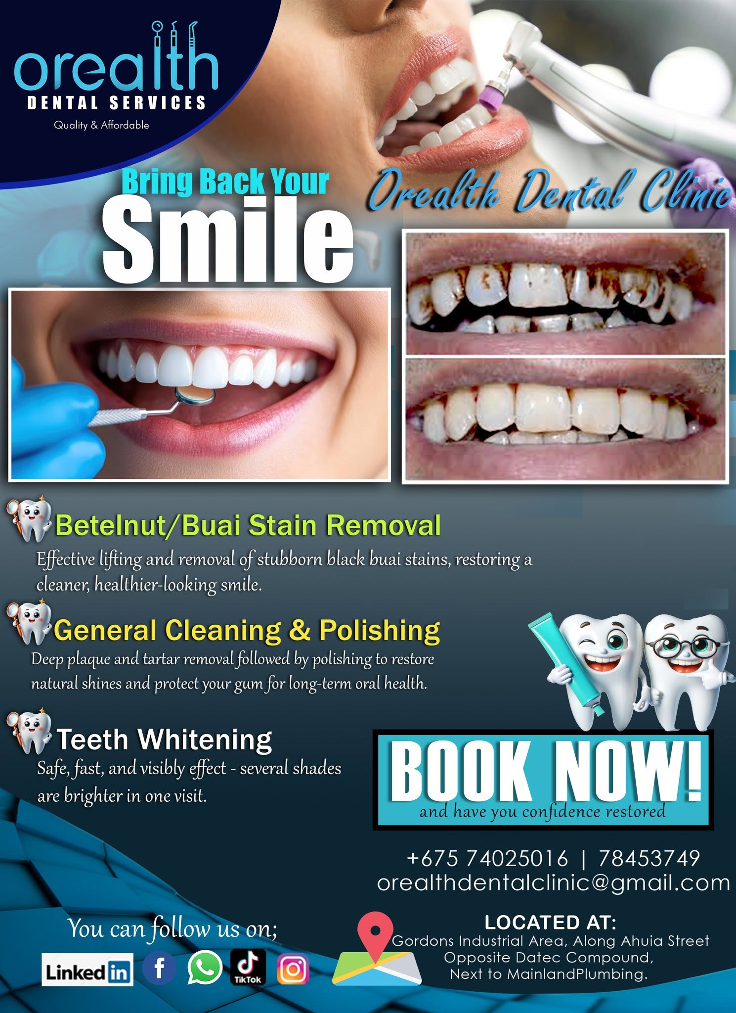 Bring Back Your Smile