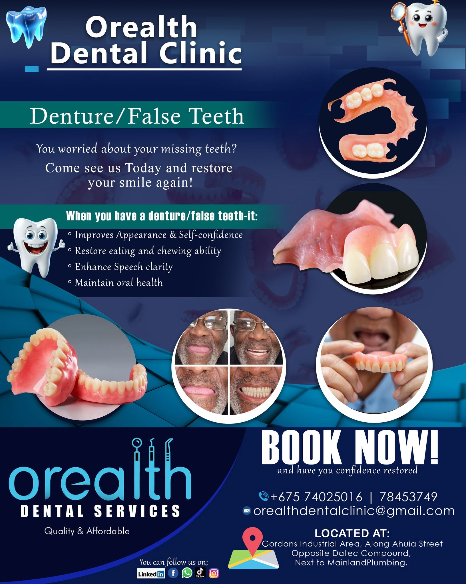 Denture and False Teeth